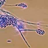 A BactoFil Cell egyik fő baktériuma a Pseudomonas fluorescens igen intenzíven vonja el a vasionokat (Fe +++ ) előlük, melynek következtében