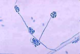 Azonosítottunk több endofita Sarocladium zeae (14. kép) izolátumot is. Ez a faj a mikotoxinogén A. flavus és F. verticillioides antagonistája, ez az első adat hazai előfordulásáról.