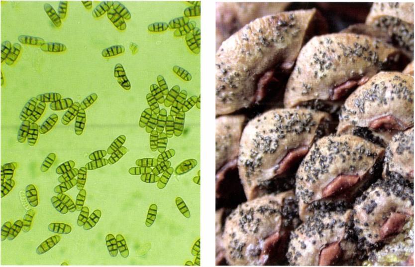 kép: Camarosporium robiniae konídiumok