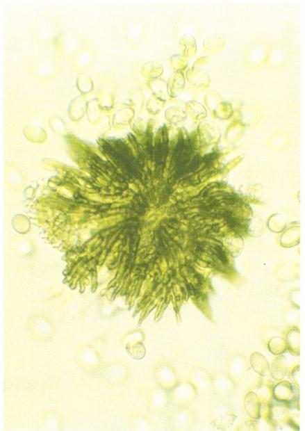 51. kép: Tubakia dryina