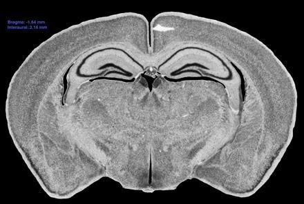 Neurosphere from new born mouse froebrain nmfhé Cortex