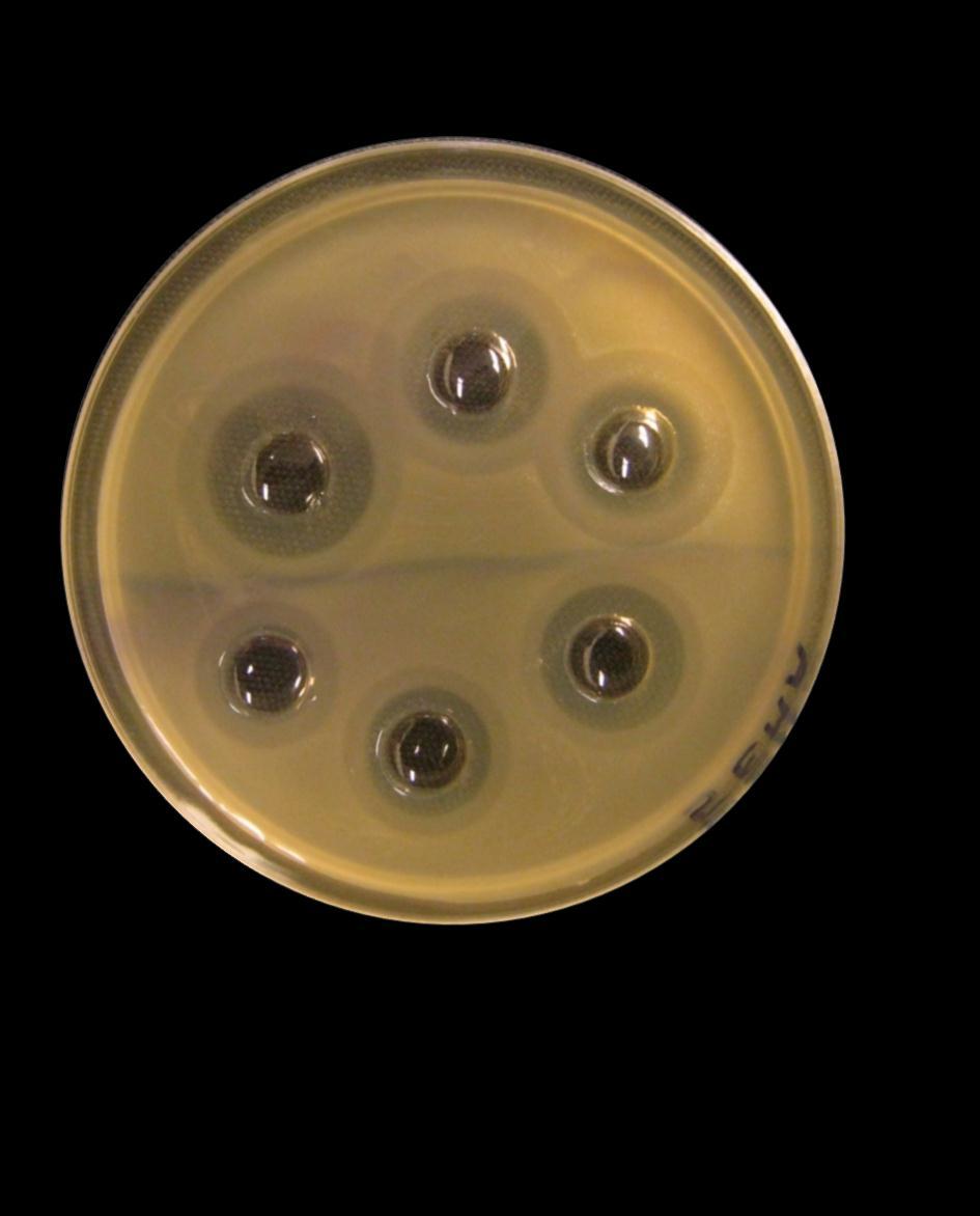 Erwinia cells db/ ml Antibiotics of EPBs EMA Cytotoxic effect of the antibiotics of X. budapestensis and X.