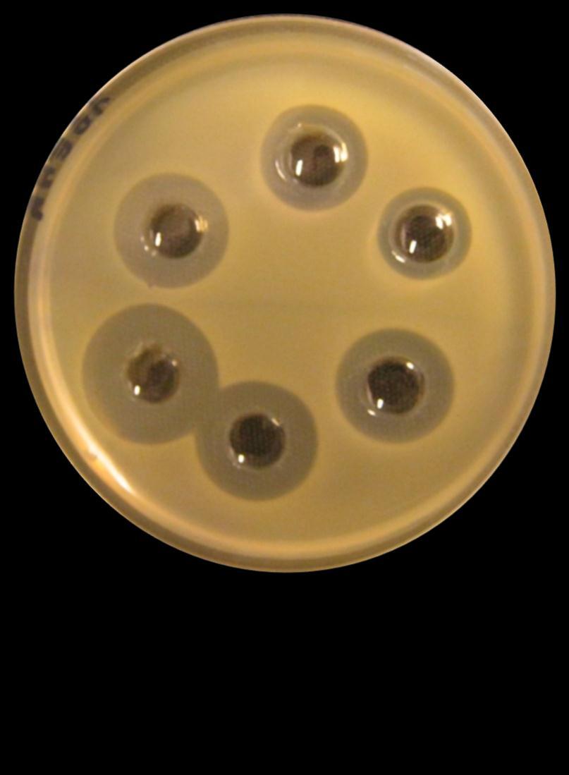 EPB antibiotics EMA EMA