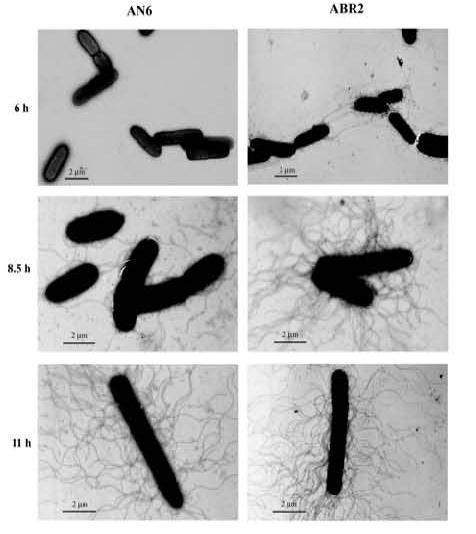 Bacterial symbionts of EPN Különböző EPN fajok szinbiontái