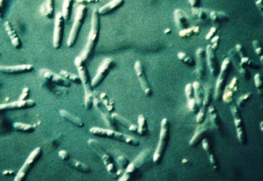 Sejtmorfológia: Colony morphology Polymorph with