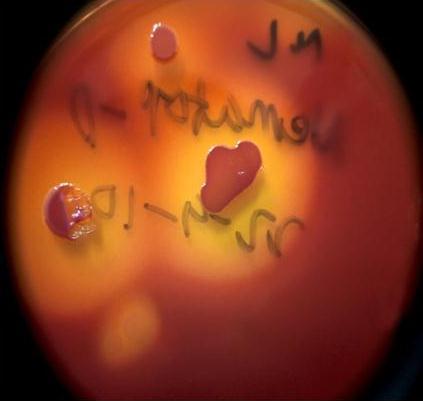 bacteriophora strains on MacConkey plates