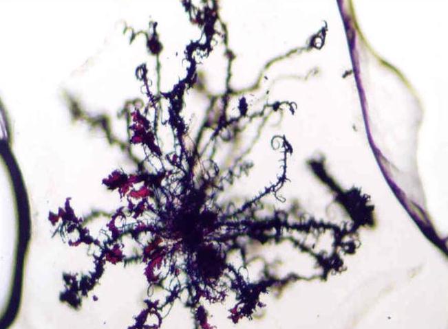 EM microanalysis and chemical identification of the exocrystal of X. szentirmaii (Fotó: Máthé-Fodor, A.