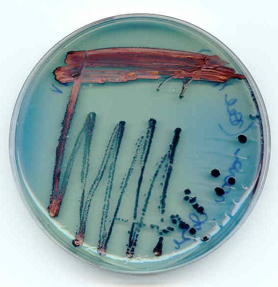 A vizsgált funkciók és fenotípusok (2) Antibiotikus iodinin