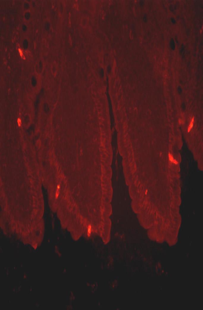 Inkretinek élettani szerepe GI peptid hormonok, a tápanyagok felszívódása során kerülnek szekrécióra Fő funkciójuk a β-sejtek inzulintermelésének glükóz-függő serkentése, az α-sejtek