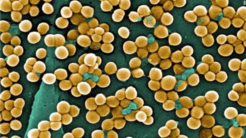 MRSA Methicillin-resistant Staphylococcus aureus (MRSA) bacteria are resistant to all beta-lactam antibiotics such as methicillin, penicillin,