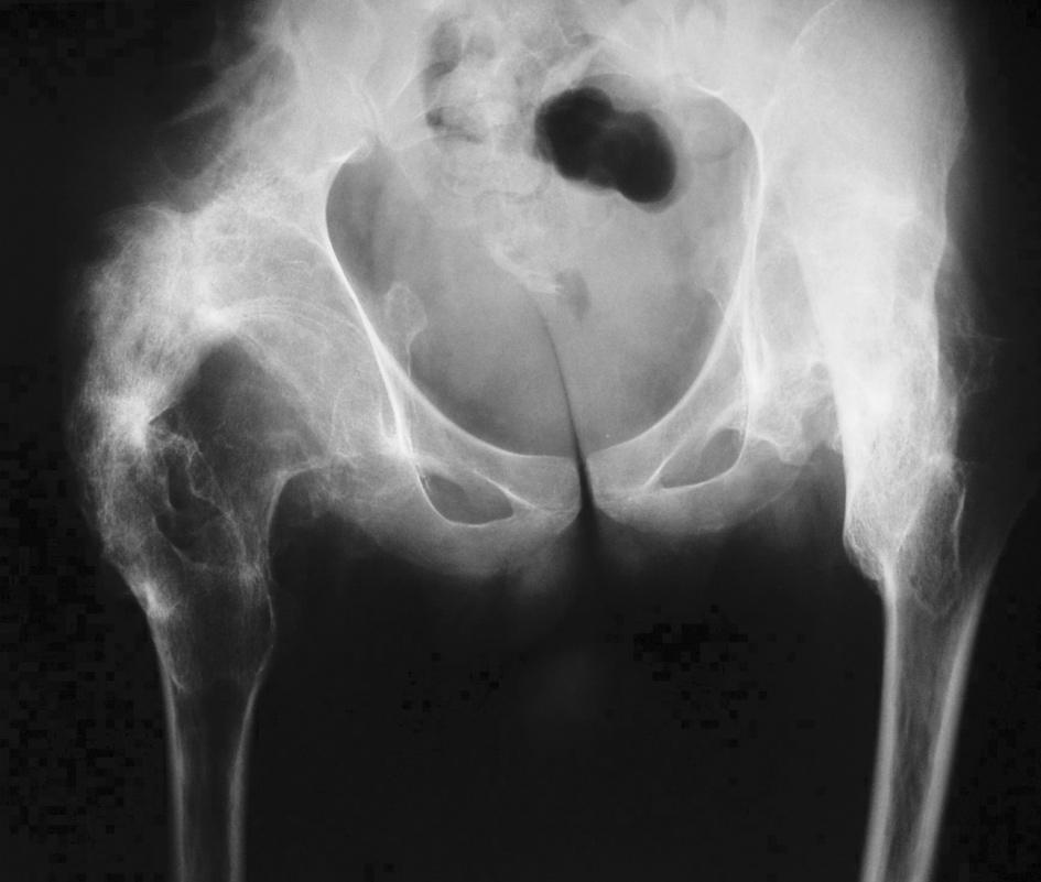 88 OSTEOLOGIAI KÖZLEMÉNYEK 2012/3 B A D C 2. kép. W. S. 21 éves férfiről (2.