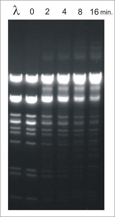 Molekuláris biológia gyakorlatok - 21 Vegyünk ki 15 µl oldatot, és tegyük a 0 jelű csőbe.