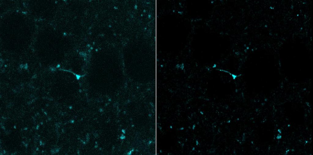 Példák Konfokál 3 csatorna, 80nm/pixel 150nm Z lépés (15), n=1.31, 100x, NA1.