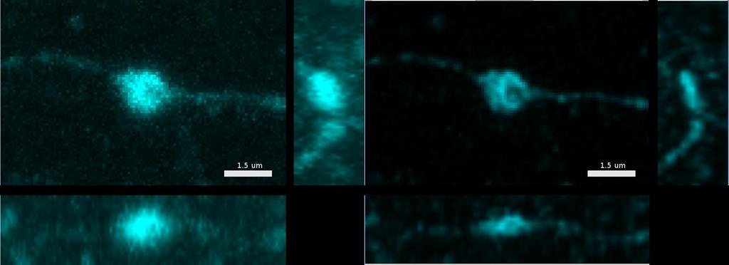 Példák Konfokál 2 csatorna, 80nm/pixel 150nm Z lépés (15), n=1.
