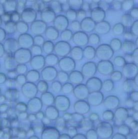 org blood RBC hisztogram Modell oldat: gombák 100 m Gomba hisztogram