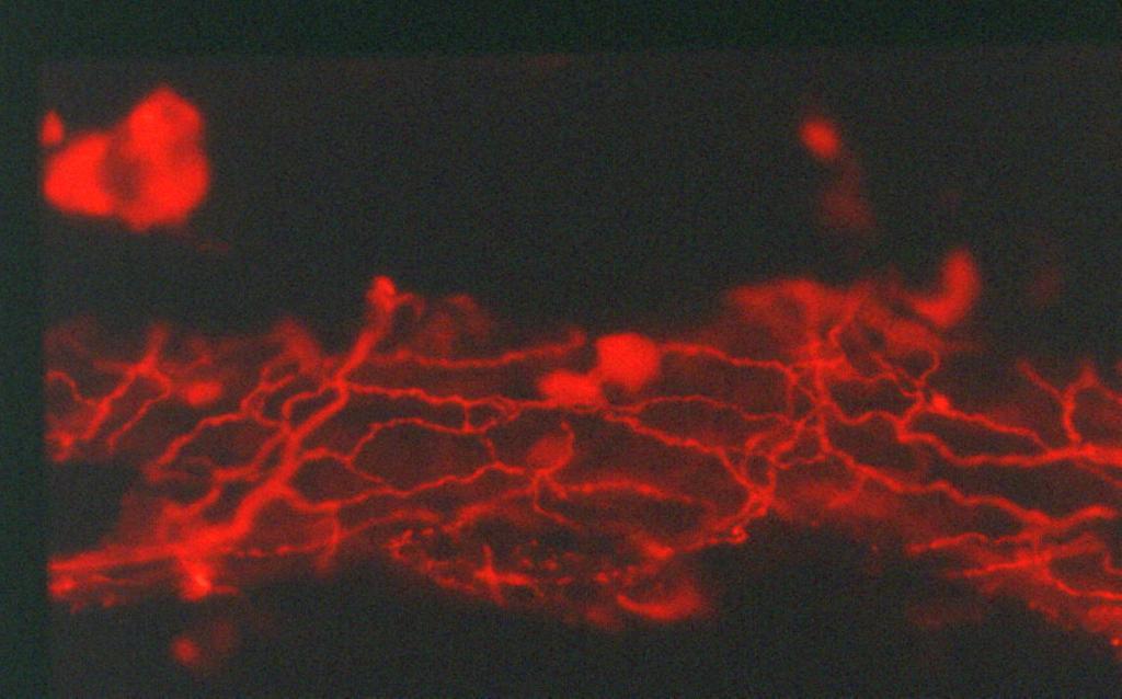 URETER