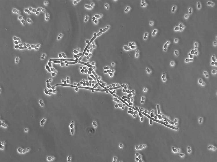 Élesztőgombák: cukor etilalkohol + CO2 + Energia Spontán is végbemegy Anaerob körülmények Erjesztésiparban használatos élesztőfajok: Saccharomyces cerevisiae: sör, bor, pezsgő S.