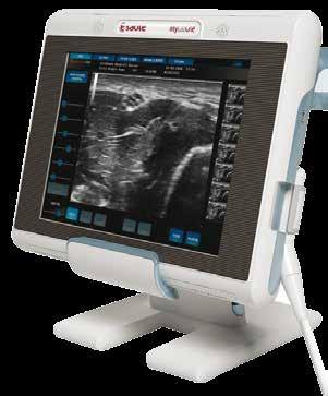 6-10 MHz up to 93o 186 mm Anaesthesiology, Pediatrics, Vascular Micro-convex Array 10-22 MHz 20x 40 mm Rheumatology, Anaesthesiology,