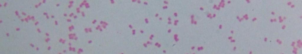 Streptococcus pneumoniae Normál flóra Apathogén Corynebaktérium Apathongén