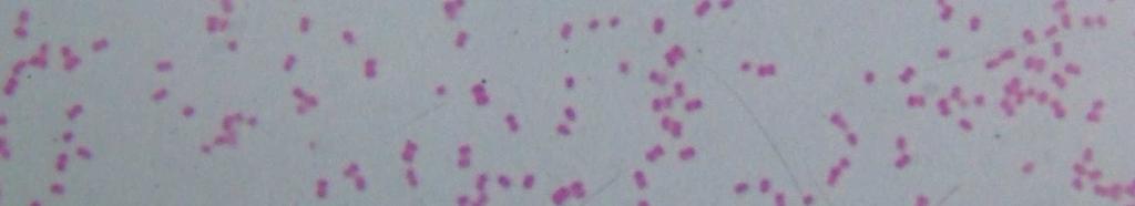 Staphylococcus zöldítı Streptococcus Micrococcus Kórokozók Acinetobacter E.