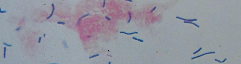 húgycsı alsó szakasza, hüvely Lactobacillusok Normál