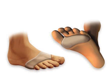 dörzsölés a lábak varikózisában