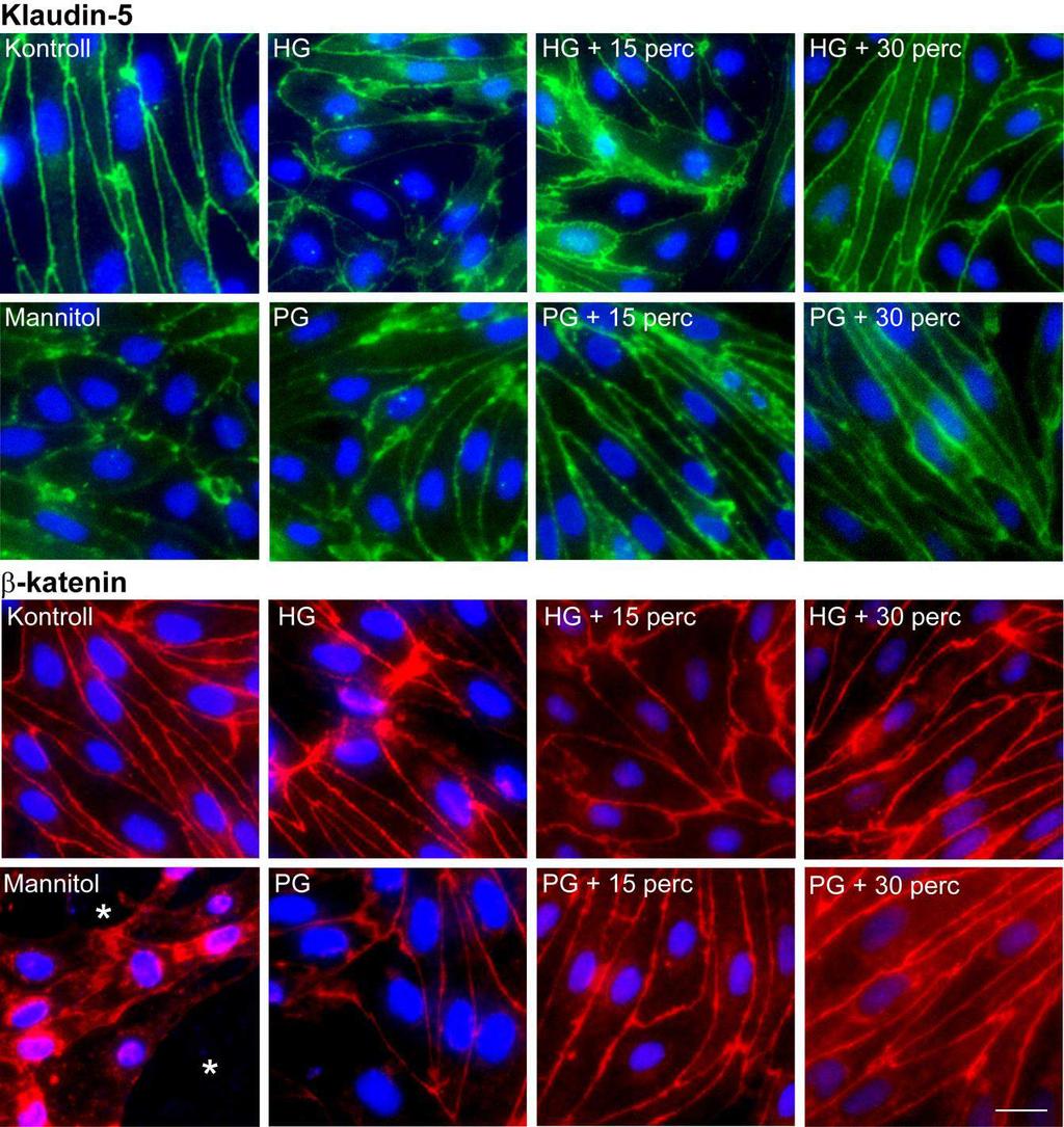 15. ábra. Alkilglicerolok hatása agyi endotélsejtek klaudin-5 és β-katenin immunfestésére. PG: pentilglicerol, HG: hexildiglicerol, M: mannitol.