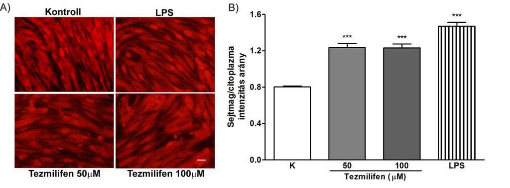 27. ábra: A) NFκB immunhisztokémiai festése agyi endotélsejteken. Mérce: 25 µm. B) Tezmilifen hatása agyi endotélsejtek NFκB korai sejtmagba történő bejutására.