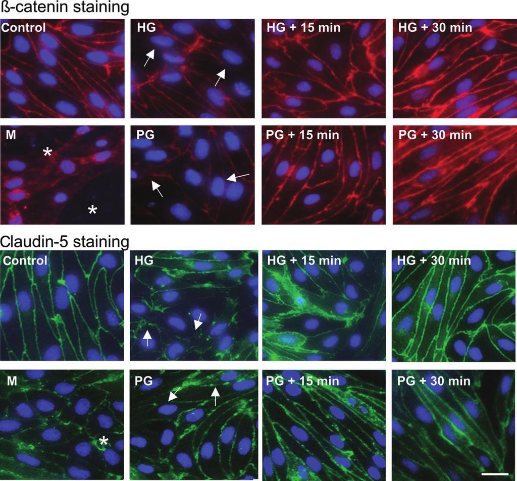 BJP P Hülper et al. Figure 4 Effect of AGs (30 mm) and mannitol (1.4 M) on immunostaining for claudin-5 and β-catenin junctional proteins in primary rat brain endothelial cells.