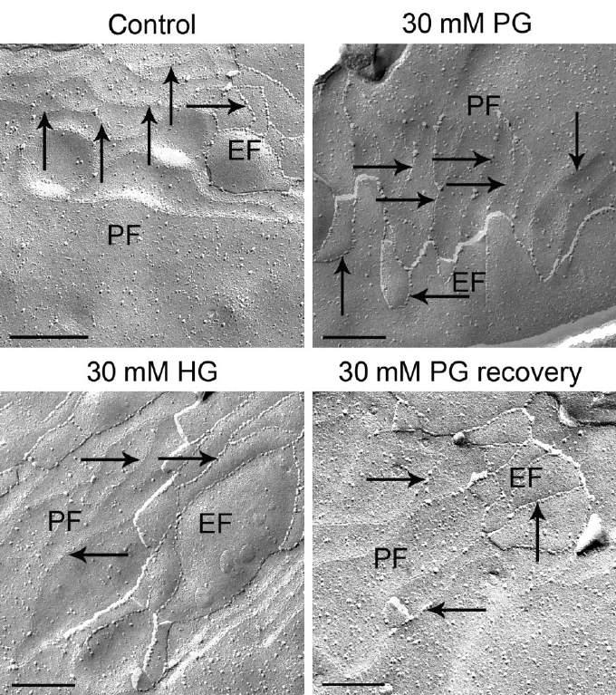 Short-chain alkylglycerols and blood-brain barrier BJP Figure 5 Freeze-fracture analysis of the complexity and morphology of tight junction strands.