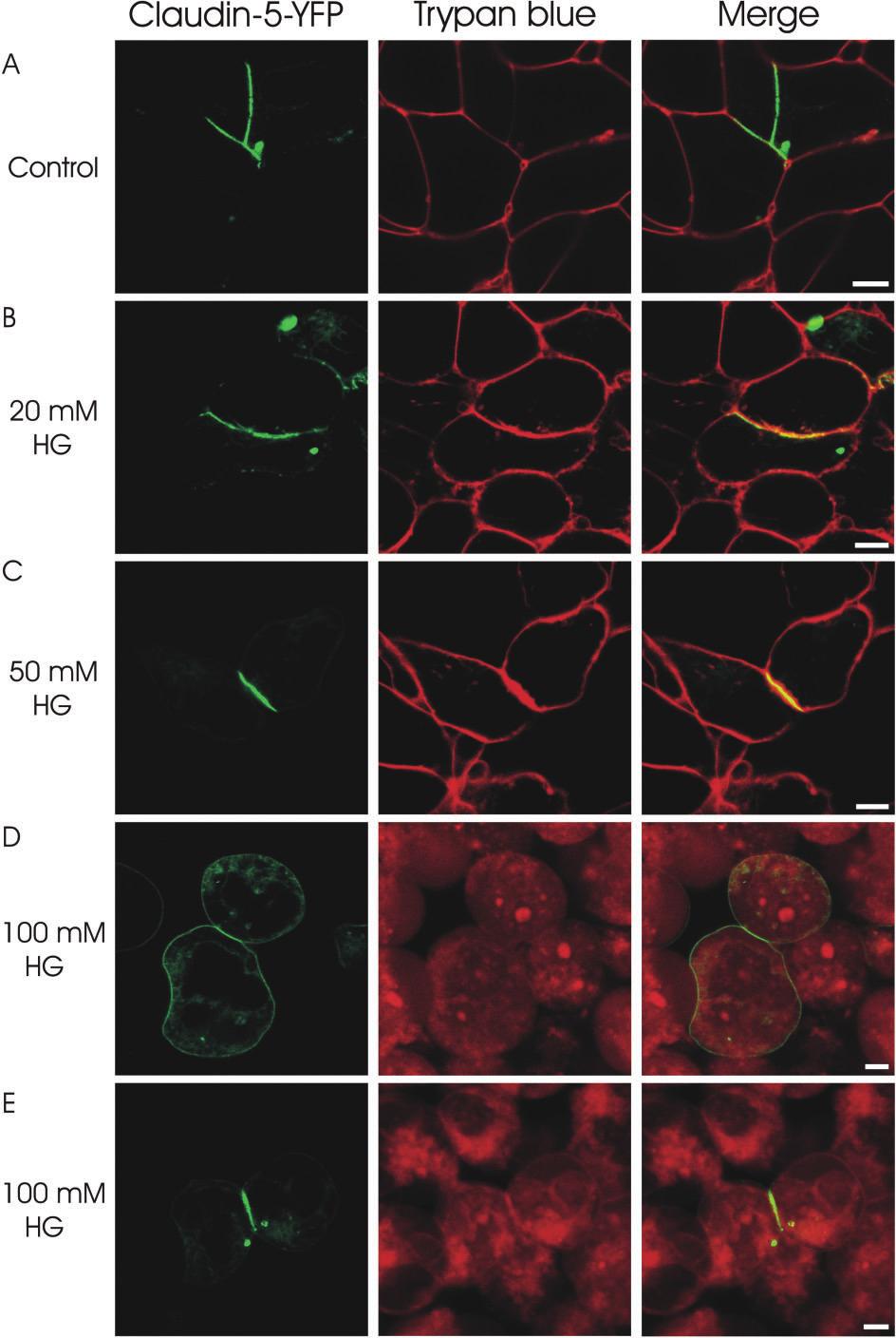 BJP P Hülper et al. Figure 6 Analysis of claudin-claudin trans-interactions in HEK293 cells stably transfected with claudin 5-YFP (shown in green) by confocal fluorescence microscopy.