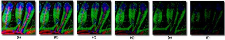 Fluoreszcenciát zavaró hatások Autofluoreszcencia : főleg UV gerjesztésnél az aromás aminosavak, nukleotidok, porfirinek is gerjesztődnek, emittálnak, kisebb jel-zaj arány)