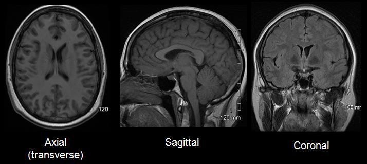 MRI síkok A szöveti és képi jellemzők sokkal bonyolultabbak, mint a CT esetén.