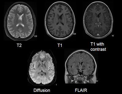 MRI: nem denzitás, hanem intenzitás!