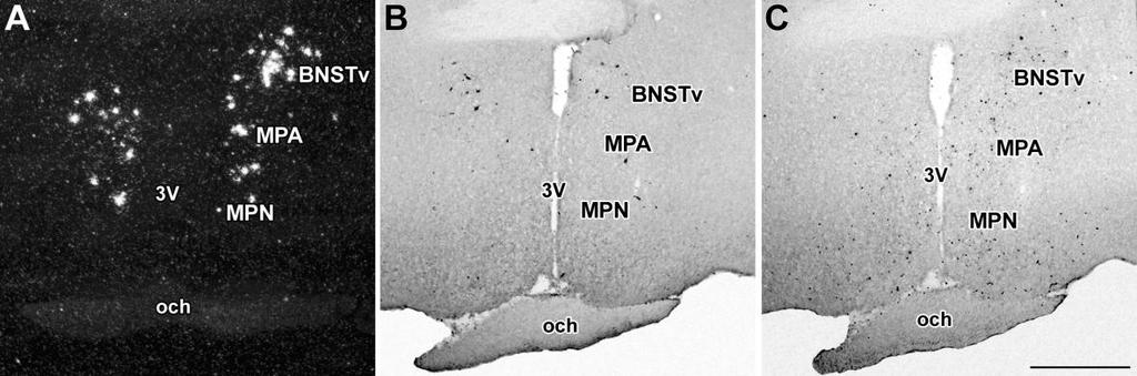 átfedő volt, így X-Gal hisztokémia segítségével PTH2R-t expresszáló sejtek voltak megfigyelhetőek az MPN, az MPA egyes területein, valamint a BNST ventrális részén. 24. ábra.