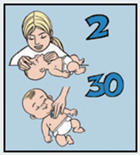 KILENCEDIK LÉPÉS 2 befújás, 30 mellkasnyomás folyamatosan 30 mellkaskompresszió után ismét lélegeztetnünk kell a babát a fent megbeszéltek szerint (tehát a légutak szabaddá tételét követően befújás