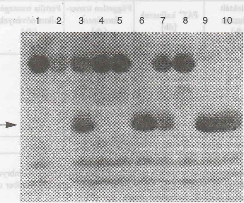 Jelmagyarázat: 1 = nem transzformált búza kontroll kallusz, 2, 4, 5 és 8 = negatív búza kallusz minták, 3, 6, 7 és 9 = pozitív búza kallusz minták, 10 = bar génnel transzformált árpa mint pozitív