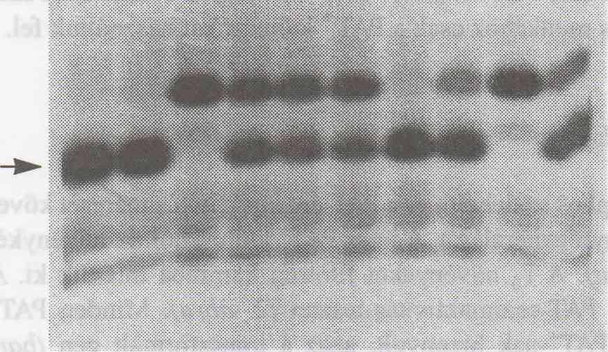 Symbols: 1 = non-transformed wheat callus, 2,4, 5 and 8 = negative wheat callus samples, 3, 6, 7 and 9 = positive wheat callus samples, 10 = bar transformed barley as a positive control. 2. ábra.