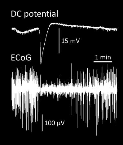 terjedő depresszió-ként ismerünk (cortical spreading depression, CSD) (1. ábra). 1. ábra Az SD elektrofiziológiai jellemzői.