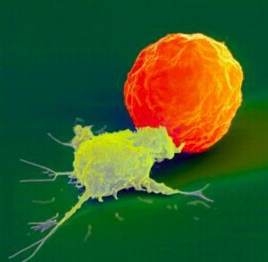 Immunsejtek Nr.18. AZ IMMUNRENDSZER SEJTJEI III. NK cell attacks a cancer cell https://restoreimmunehealthdotcom2.wordpress.com/2012/09/04/wha t-are-natural-killer-cells/ 7.