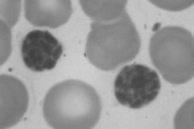 daganatos sejtek elpusztítása cellularis immunitás NK (Natural Killer) sejt: nagy granularis lymphocyta, cellularis immunitás MONOCYTA - 4-8% átmérő: 15-20 μm mag: bab alakú phagosoma a
