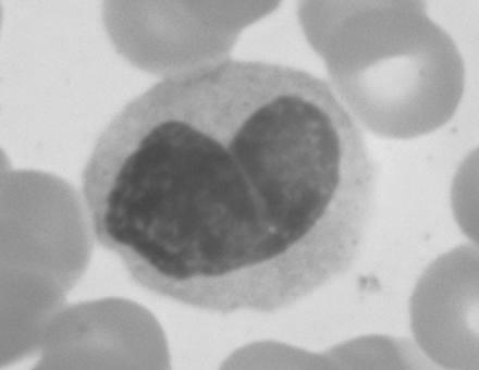bemutatása Szöveti macrophag-vonal (reticuloendothelialis rendszer): Dendritikus sejtek(bőr, nyálkahártya) fő antigénbemutató Kupffer-sejtek(máj): elöregedett vörösvértestek kivonása