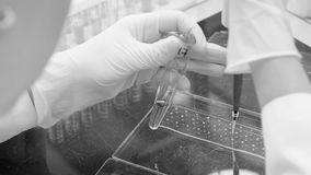 alultápláltság, égés, hasmenés Antitripszin α 1 - globulin 2-4 g/l