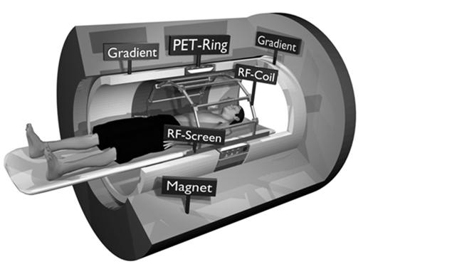Erős mágneses tér MRI jel: 2.