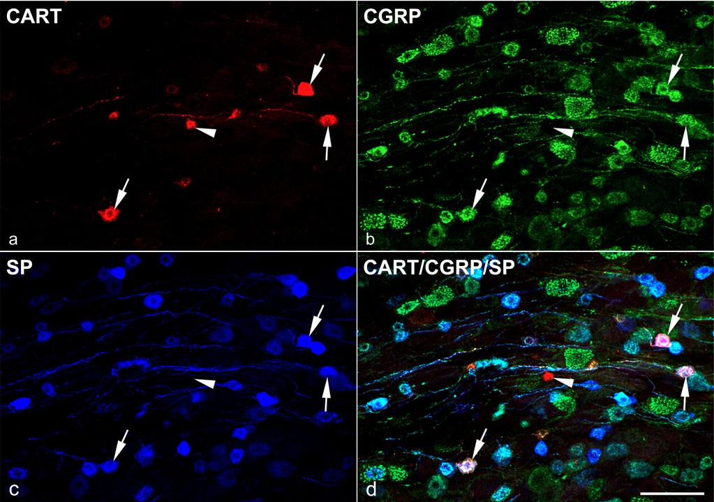 Eredmények A spinalis gangionokból készült metszetekben kevés (10% alatti) CART peptidet exprimáló sejtet és rostot láttunk.