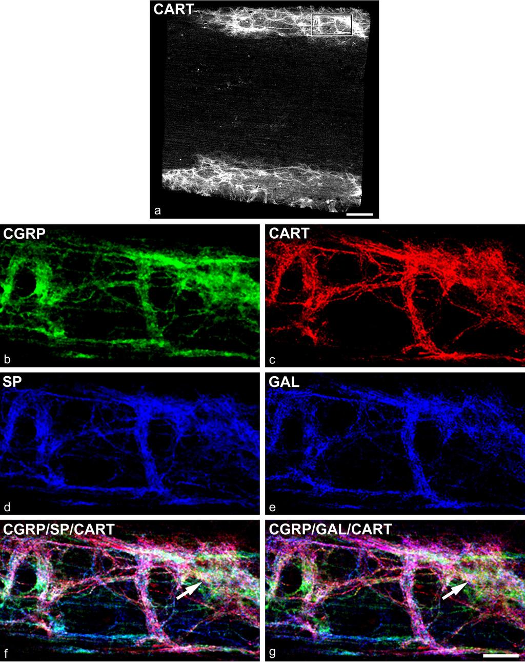 Eredmények peptid a CGRP/SP-immunpozitív végzıdések 49,0%-ában volt jelen (21. és 22. ábra, 3. táblázat). 21. ábra: A patkány gerincvelı horizontális metszete négyes immunfluoreszcens jelöléssel.