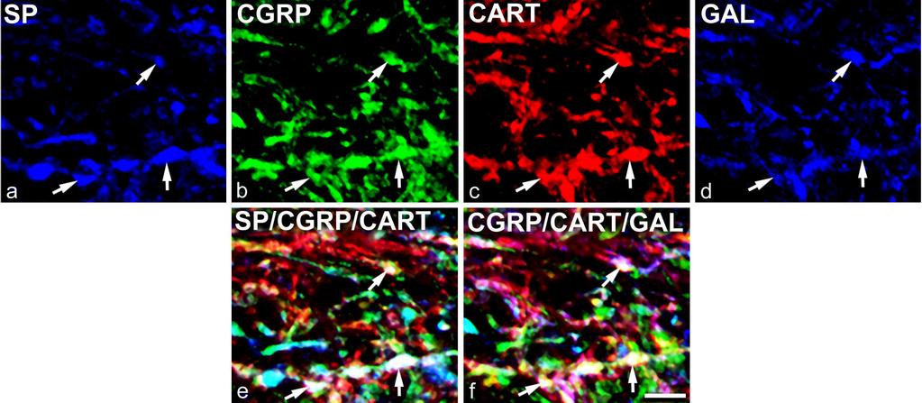 Eredmények A lamina I területén a CGRP/SP-tartalmú boutonok többsége (81,4%) galaninpozitív volt és a CGRP/SP/galanin-immunreaktív terminálisok mintegy fele (51,5%) tartalmazta a CART peptidet.