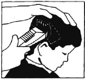 Slo Strižnik za lase in brado upravljanje ZATILJE nastavek za nastavljive dolžine striženja (C) nastavite na želeno dolžino striženja. Postopajte tako, kot je opisano v poglavju Področje vratu.
