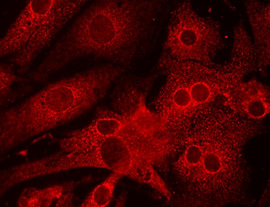 asszociált protein (14. ábra). Ez utóbbi magyarázata talán az lehet, hogy normál sejtkultúráktól eltérően, a cardiomyocyták osztódásra képtelen sejtek. 14.