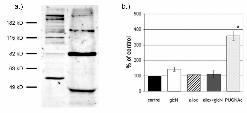 17. ábra: A.) CTD110.6 western-blot. Bal oldalt: normál, nem immunprecipitált sejt-extraktum, jobb oldalt: TRPC-1 ellenes antitesttel (Santa-Cruz ) immunprecipitált sejt-extraktum. B.) A 80 kd magasságnak megfelelő protein-sáv denzitometriája glükózamin, alloxán ill.